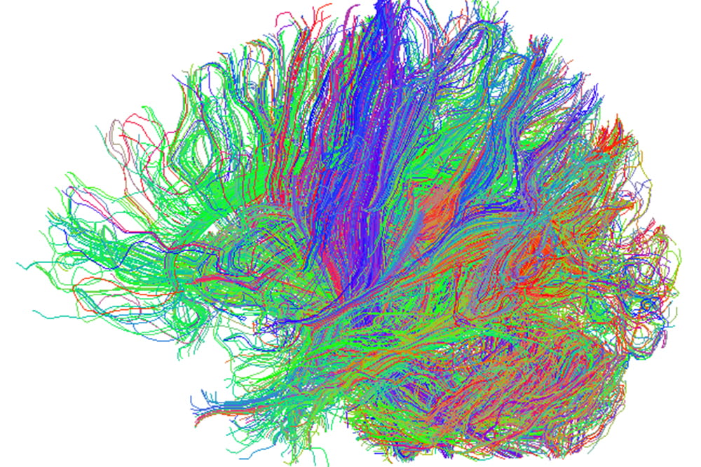 Squiggles in green, red and blue show the neural tracks in the brain