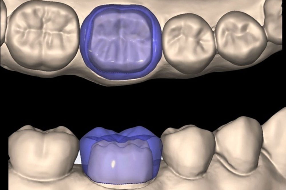 Illustration of teeth.